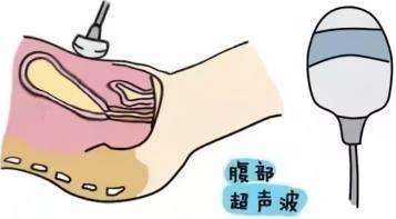 2025澳門正版資料免費和医生误做腹超被停工与医生误做腹超被停工怎么赔偿