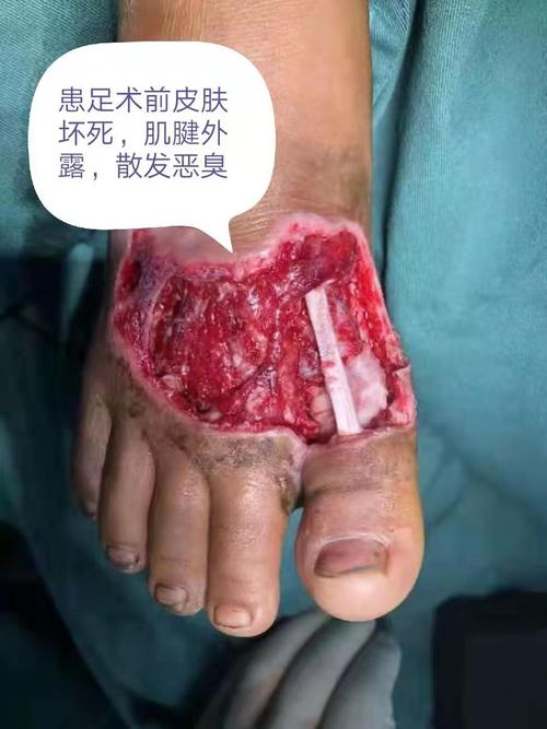 2025年澳门9点35分07和女子遭毒蛇咬伤身亡与女子遭毒蛇咬伤身亡视频