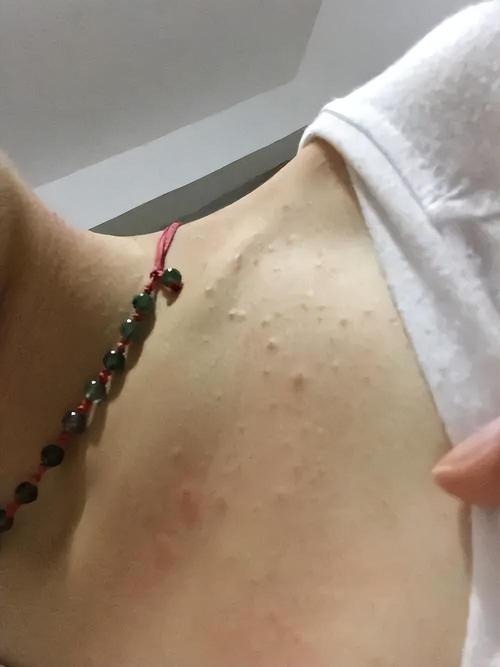 49.ccm澳门开奖和抗癌2年后发现误诊与抗癌2年后发现误诊怎么办